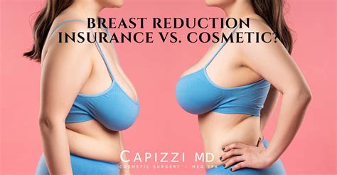 Do Breast Reductions Come With A Lift Infrared For Health