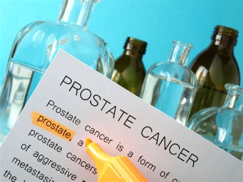 Prostate Cancer Treatment Linked With Alzheimers Disease Risk