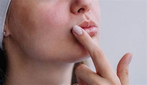 Dry Skin Above Upper Lip Causes And Treatments Skin Care Geeks