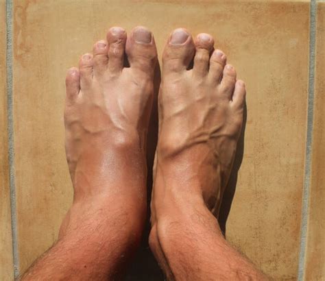 How To Reduce Ankle Swelling Taking Care Of Your Body Step To Health