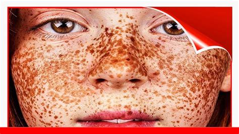 Unique Beauty Of Freckled People Documented By Brock Elbank 😃 Youtube