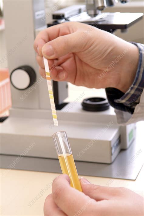 The term urinalysis—a blend of the words urine and analysis—generally refers to the gross examination of the urine. Urine analysis - Stock Image - M870/0081 - Science Photo ...