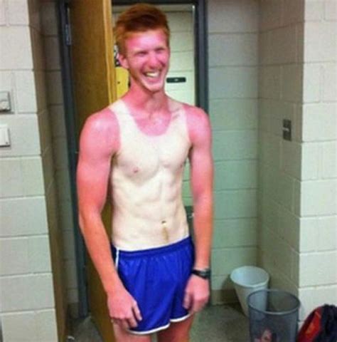 Worst And Funniest Sunburn Ever Mirror Online
