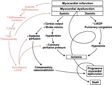 Cardiogenic Shock Complicating Acute Myocardial Infarction Circulation