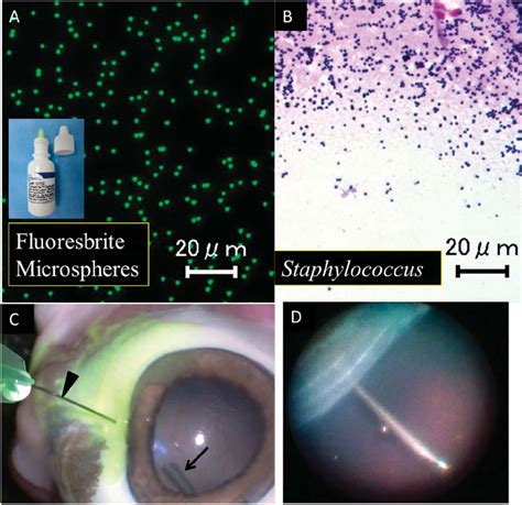 Enucleated Porcine Eyes Served As A Type 1 Experimental Vitreous