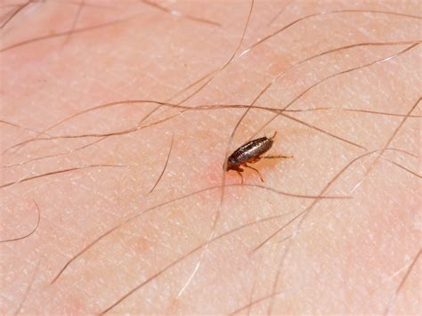 Kill Fleas On Humans Pest Phobia