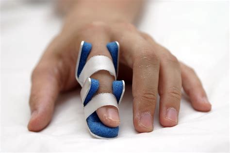 Mallet Finger Definitions Symptoms And Treatment Treat Finger Injury