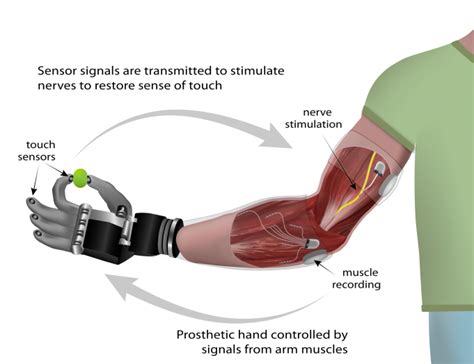 DARPA Restores Man's Sense of Touch By Connecting Prosthetic to the