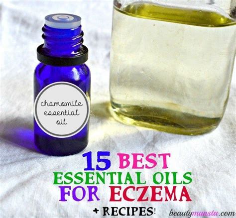 Aquís How You Can Treat Eczema With 15 Of The Best Essential Oils