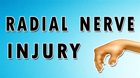 Nerve Deep Exploring The Anatomy Of Radial Nerve Injuries Youtube