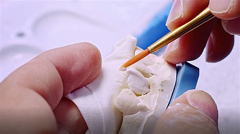 Why Work With Pro Craft Instead Of Another Dental Lab For Less