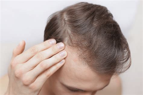 Itchy Scalp Causes And Connections To Hair Loss