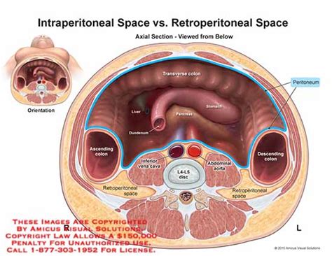 Retroperitoneal Anatomy Exhibits