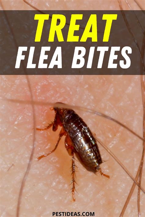 Think That You Have Been Bitten By A Flea Get Relief Fast Treat Flea