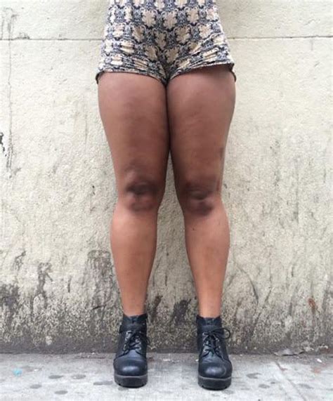 This Instagram Account Proves All Legs Are Beautiful Thigh Gap Or Not
