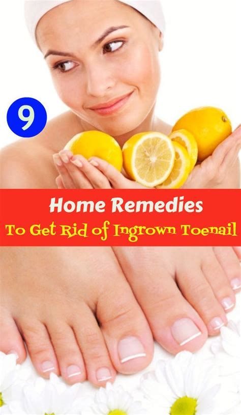 How To Get Rid Of Ingrown Toenails With 10 Home Remedies Ingrown Toe
