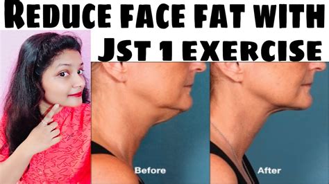 Lose Your Face Fatreduce With Just One Exercise Youtube