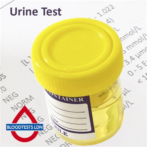 Schistosoma Urine Test In London Order Online Attend Blood Tests