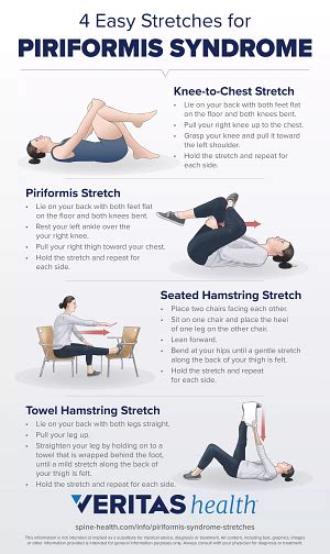 2 Essential Stretches To Relieve Piriformis Syndrome Symptoms Spine Health