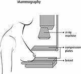 Used Mammography Equipment Photos