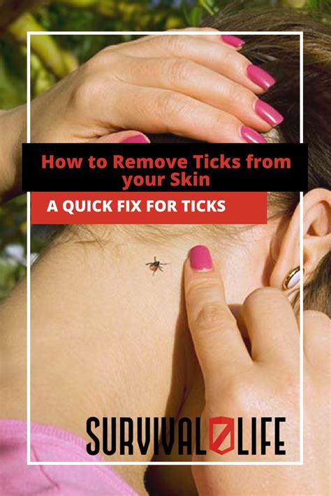 How To Remove Ticks From Your Skin Tick Removal Ticks Deep Cleaning