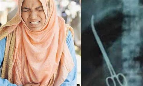 Scissors Stuck In Womans Stomach During Surgery Charge Sheet To Be Submitted In Court News