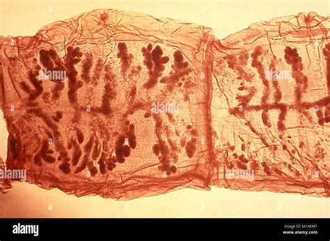 Proglótides Tenia Taenia Solium órgano Morfología Revelada En La