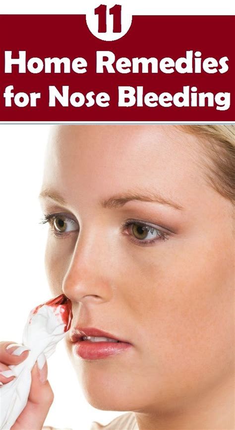 Top 11 Home Remedies For Nose Bleeding Home Remedies Remedies Nose Bleeds