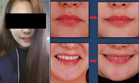 The Rise Of The Perma Smile New Trend Out Of South Korea