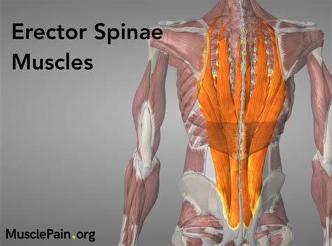 Erector Spinae Trigger Points Muscle Pain