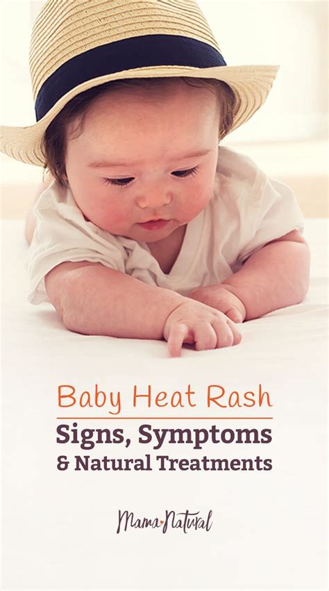 Nearly Half Of All Infants Develop Baby Heat Rash Learn What It Is