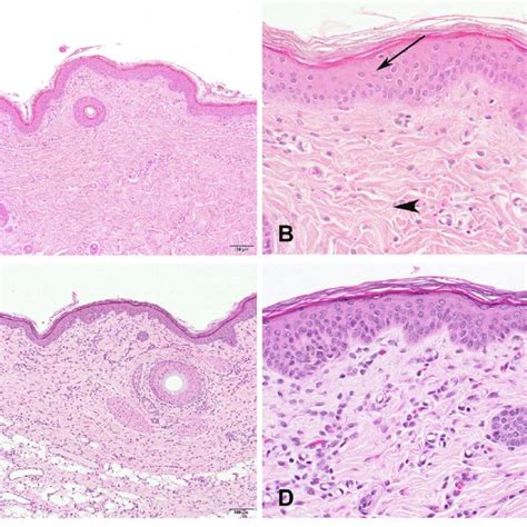 Normal Skin Histology In Adult And Neonatal Pigs Skin Biopsies Of