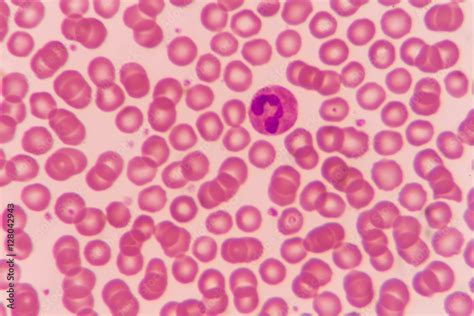 Normal Red Blood Cells Under The Microscope Stock Photo Adobe Stock