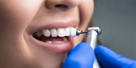 Are You Worried About Tooth Enamel Erosion