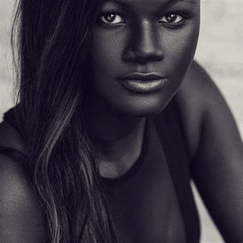 Teen Bullied Extremely Dark Skin Color Becomes Model Takes Internet