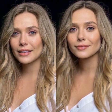 Elizabeth Olsen Nose Job Before And After