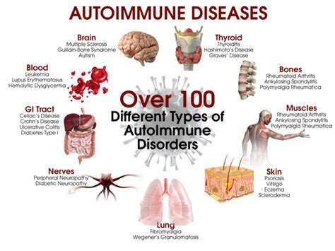 Autoimmune Diseases On The Rise