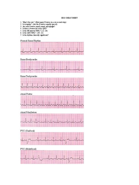 Printable Ekg Cheat Sheet Printable Template