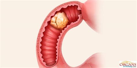 What Is The Function Of The Small Intestine Location Parts Diseases