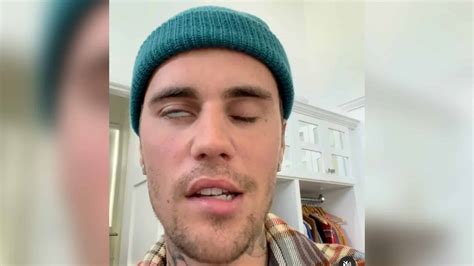 justin bieber cancels 2023 tour dates because of persistent face paralysis issue survive the news