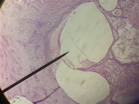 Cochlea Histology