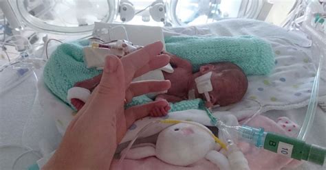 Miracle British Baby Born Four Months Early Who Just Wouldnt Give Up