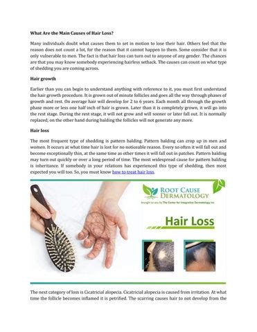 What Are The Main Causes Of Hair Loss By Root Cause Dermatology Issuu