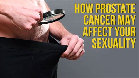 How Prostate Cancer May Affect Mens Sexuality Youtube