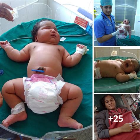 Unexpectedly Weighing Kilograms At Birth The World S Heaviest Newborn Baby Girl Astounds