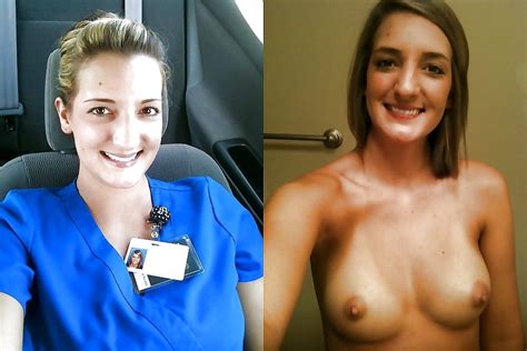 Before And After Great Tits 13 15 Pics Xhamster