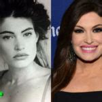 Kimberly Guilfoyle Plastic Surgery: A New Youth For News ...