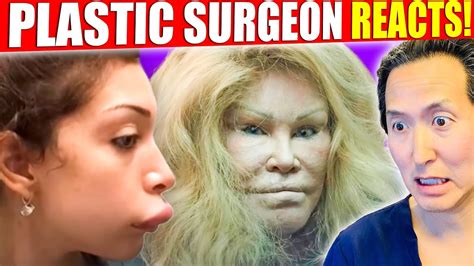 Plastic Surgeon Reacts To WORST Celebrity Surgery DISASTERS YouTube