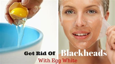 How To Get Rid Of Blackheads With Egg White