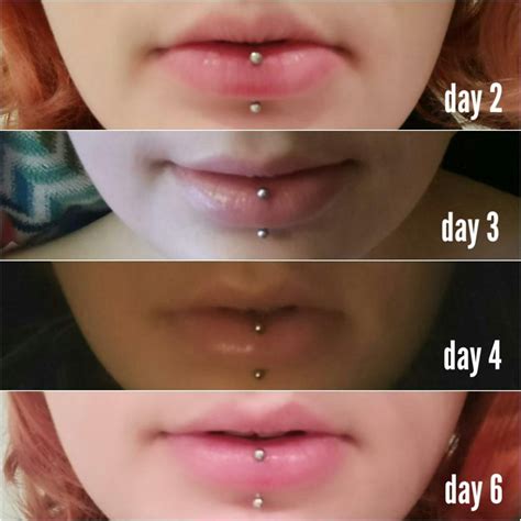 Vertical Labret Pain Procedure Healing And Aftercare Dailyhawker